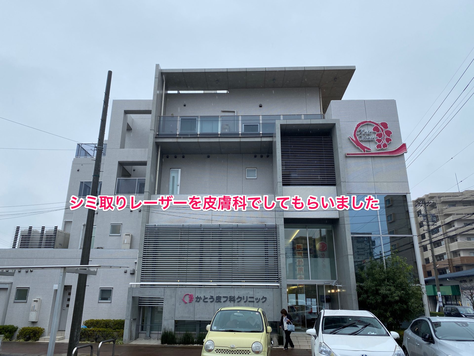 シミ取りレーザーを小牧のかとう皮フ科でしてもらいました 値段は？ 経過は？ – けんちゃんはこれからも働き盛り